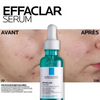 Effaclar Salicylic Acid Serum