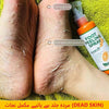 Foot Peeling Spray, Orange Oil Essence, for Dry and Callused Skin Care