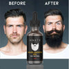 Organic Beard Oil, Nourish & Enhance Your Beard Naturally, for Men