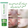 Brufoli Control Cream, Effective Acne Treatment, for Clearer, Healthier Skin