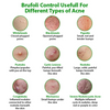 Brufoli Control Cream, Effective Acne Treatment, for Clearer, Healthier Skin